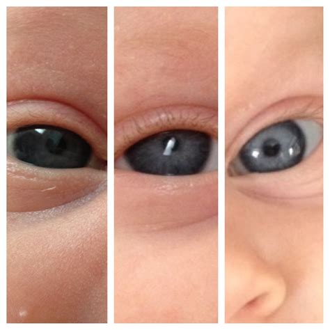 Baby Eye Color Change To Brown at Autumn Allen blog