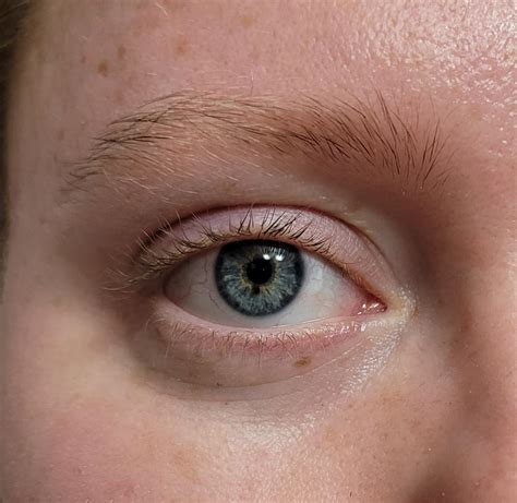 Brown Eyes With Blue Specks