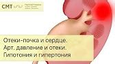 Как понизить артериальное давление-мой способ - YouTube