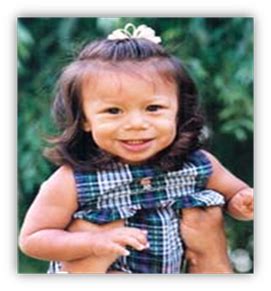 6 Developmental Disabilities Part II Flashcards | Quizlet