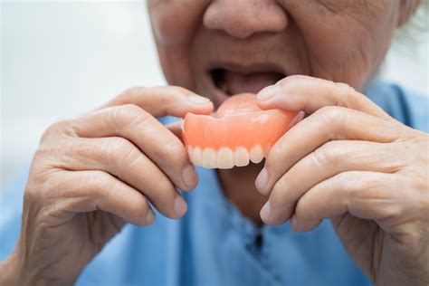 partial denture clasp types stomadent dental lab