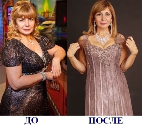 Бандажирование желудка!!! / Блог им. maliw / ВсеОкрасоте.ру