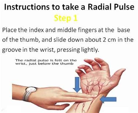 Radial Artery - Location in the Arm for Radial Artery Catheterization