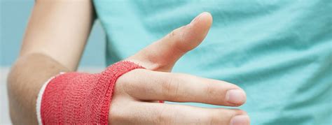 how to know if i fractured my finger