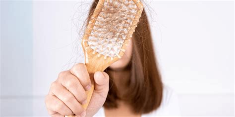 O Que É Bom Pra Queda De Cabelo - O que é bom para queda de cabelo: Descubra soluções eficazes