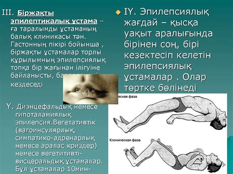 Эпилепсия. Этиологиясы - презентация онлайн