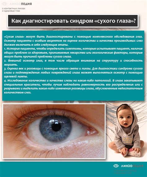 Сухой глаз. симптомы синдрома сухого глаза. причины сухости в глазах ...