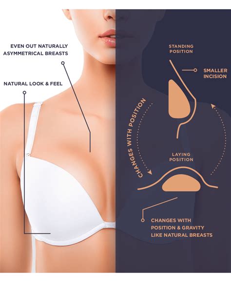 How Heavy Are Breast Implants at Amber Warren blog