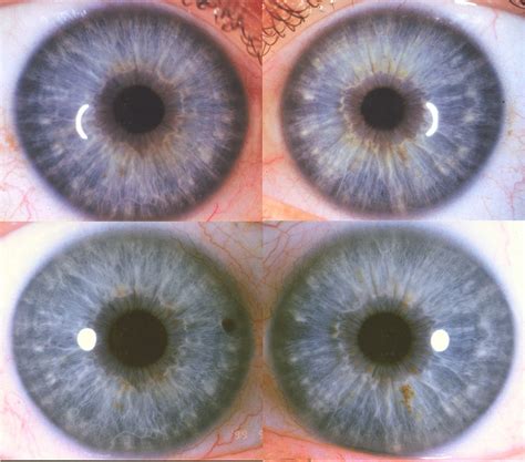 Why Do Iris Change Colors at Danielle Haynes blog
