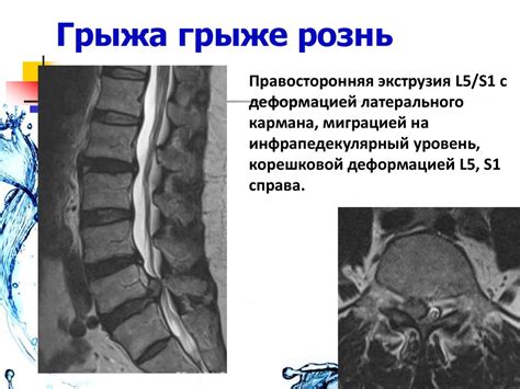 Боль в спине - презентация онлайн