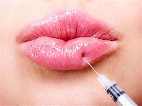 Filler Age: Guidelines & Safety at The Skin Company