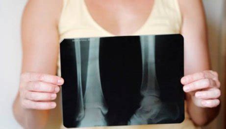 5 simptome ale cancerului osos primar - Doza de Sănătate