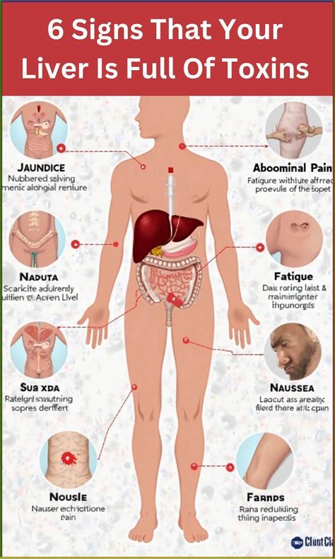 Pin on Toxic Liver Signs