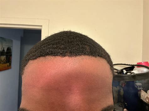 What To Do When Barber Pushed Hairline Back at Edward Gratwick blog