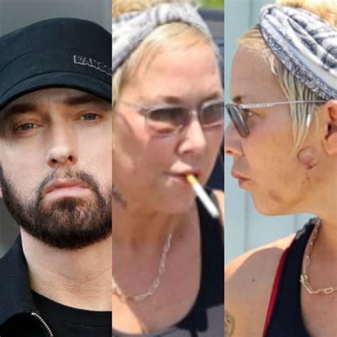 Eminem's ex-wife, Kim Mathers is seen with injury on her face (photos)