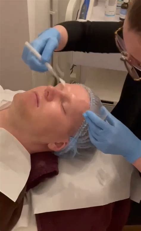 Chemical Peel - Harley Street Clinic Harpenden & Surrey