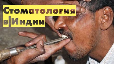 Стоматология в Индии. Не для слабонервных | Интересные факты - YouTube