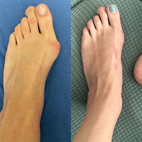 InfluencerGoneWild's Biggest Before & After? This One's UNREAL. Image 16