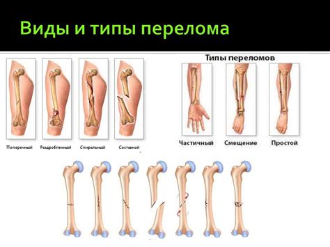Первая медицинская помощь при травмах - презентация онлайн