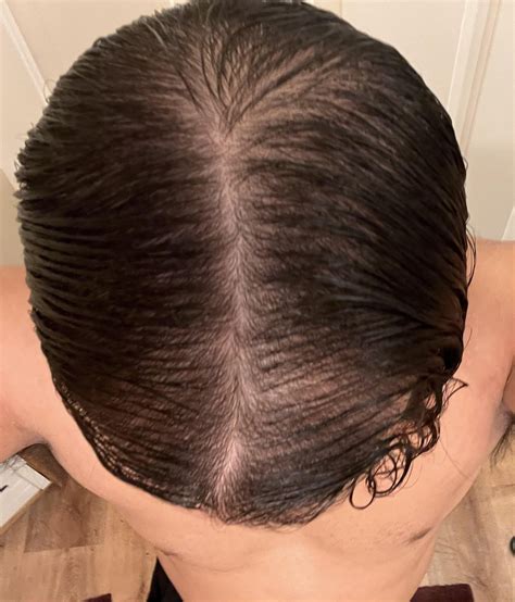 Is my hair thinning/loss? Or is it because I’m keeping my hair long