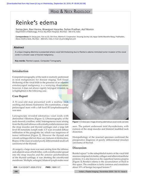 reinkes edema