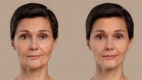 superstars   anti aging  skin care clinic