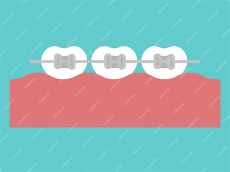 Premium Vector | Metal braces dental orthodontic teeth with braces
