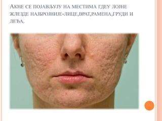 обољење i повреде коже | PPT