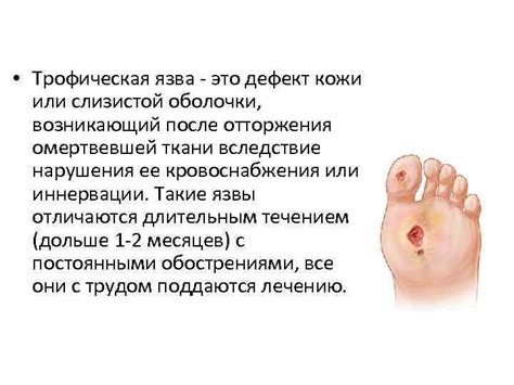 Трофические язвы Трофическая язва