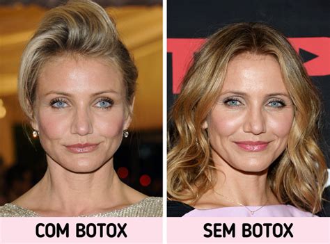Padroes De Beleza Impostos Pela Sociedade