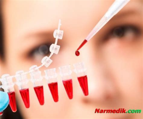 Анализ на эстроген » Narmedik.com Медицинский портал - про Новости ...