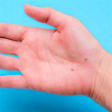 Mole On Body: शरीर के इन हिस्सों पर है तिल, जानिए इसका शुभ और अशुभ संकेत
