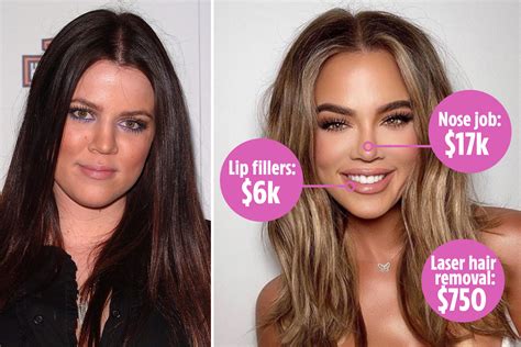 How Khloé Kardashian has spent £40k on her face, including £14k on