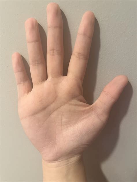 38F, R hand dominant, overwhelmed. Any insights can help. Thank you : r