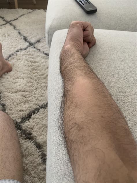 Forearm Hair Patch Gone - Burning Sensation : r/skin