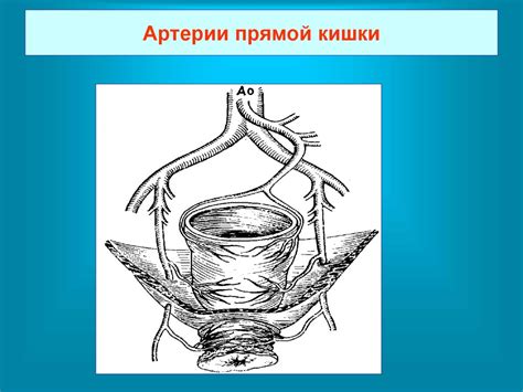 Хирургические заболевания прямой кишки - online presentation