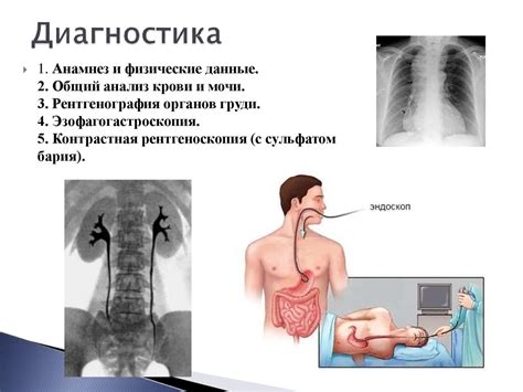 Заболевания пищевода - презентация онлайн
