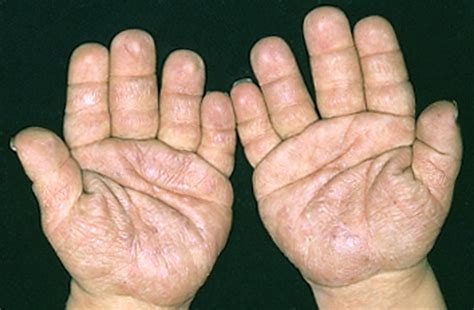 Elements of morphology: standard terminology for the hands and feet ...