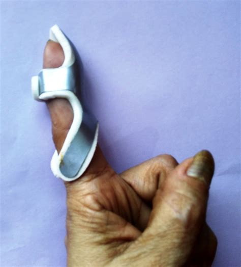 How to Make Your Own DIY Splints - Off The Beaten Grid