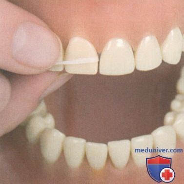 Зубная нить (флосс) для очищения межзубных промежутков при болезнях ...