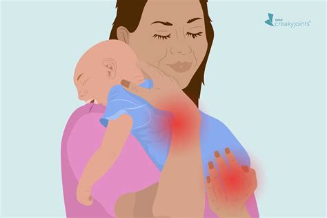 ACR 2021: 100+ Arthritis and Rheumatic Disease Updates