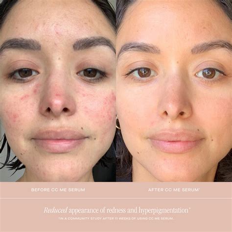 cc  vitamin  serum summer fridays