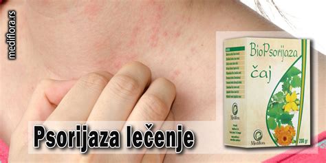 Psorijaza lečenje - Mediflora