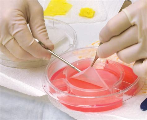 A Top-Down Analysis on Skin Substitutes - iData Research