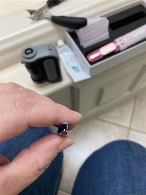 Help! First wart EVER. Small ball popped out. Is it over? Should I stop