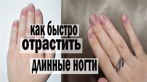 Как ОТРАСТИТЬ ногти за 3 ДНЯ | УХОД за ногтями // УКРЕПЛЕНИЕ ногтей и ...