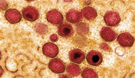 Philippines ramps up campaign over outbreak of African swine fever