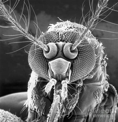 Scanning Electron Microscope View by Bettmann