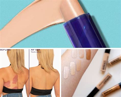 Best Body Concealers To Hide Unwanted Skin Issues or Flaws!