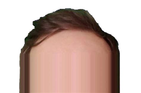 The top of the Head : r/UpvoteForehead